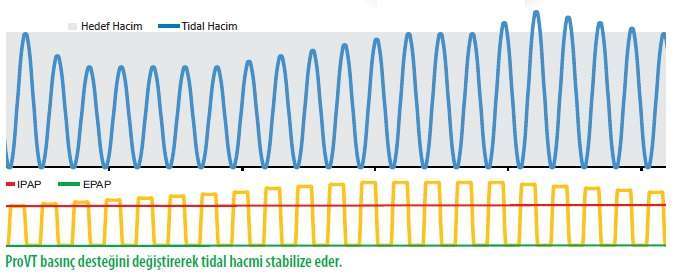 SleepOne ProVT (Bipap S/T AVAPS) Ventilasyon Cihazı